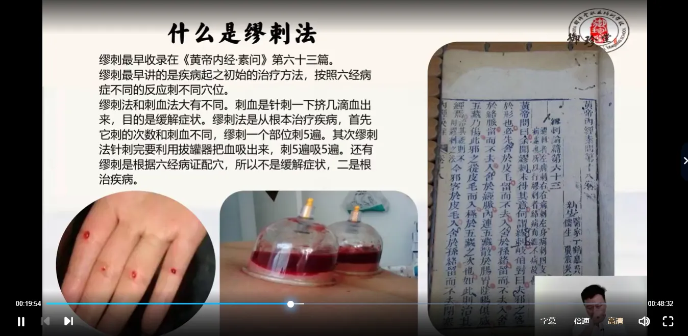 图片[3]_承文-易医绝技：伏羲九针缪刺疗法（视频7集）_易经玄学资料网