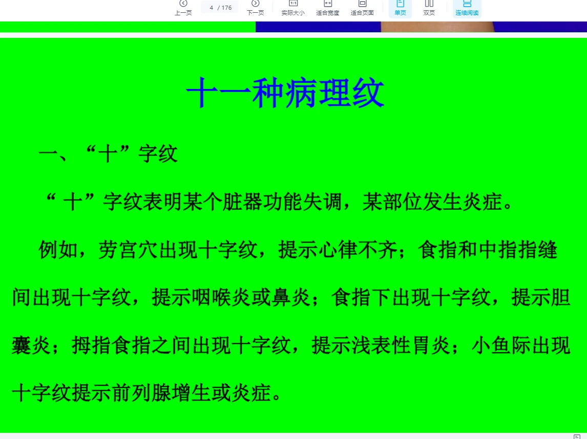 图片[3]_《栾氏全息掌纹诊病》课件PDF（176页）_易经玄学资料网