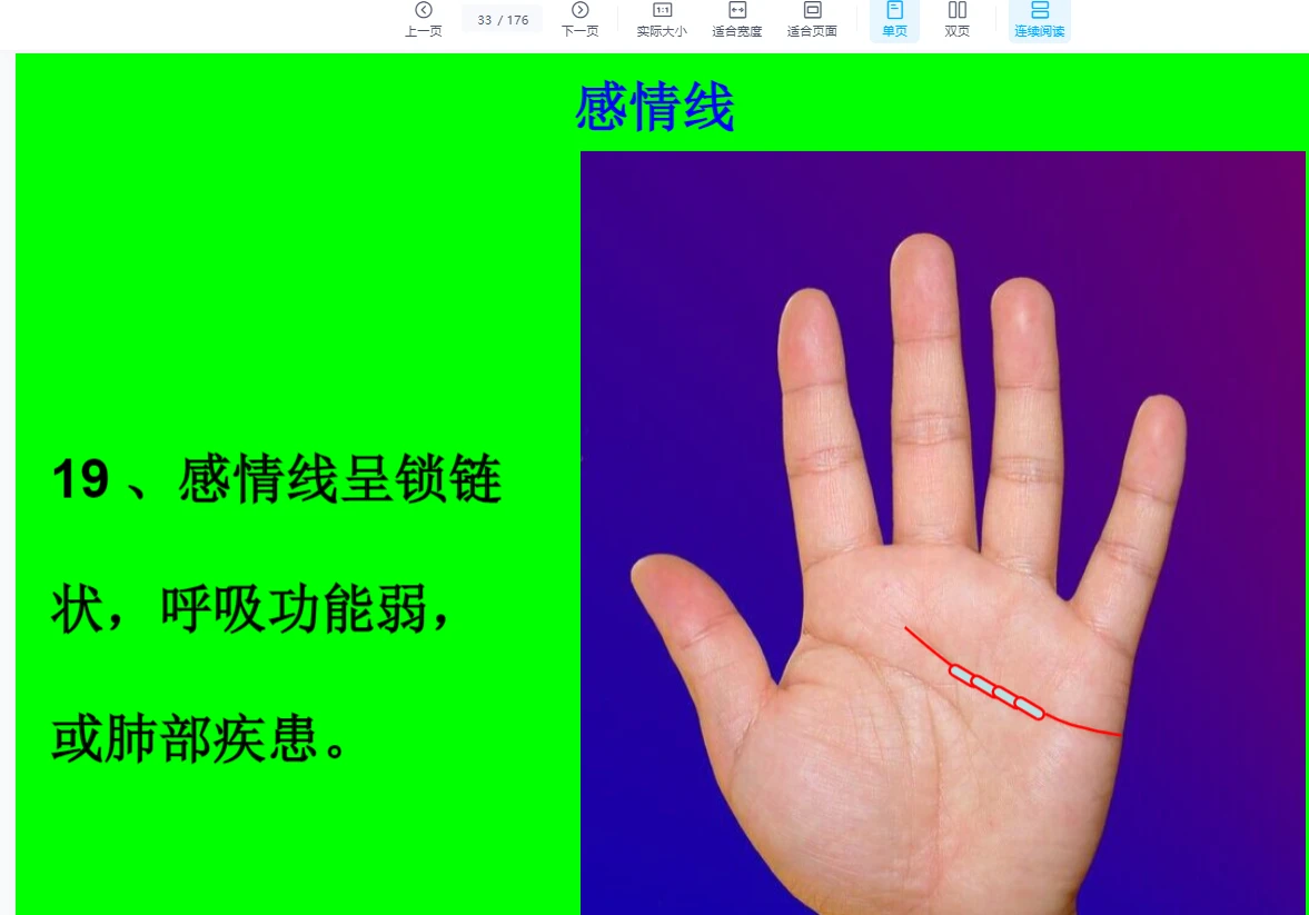 图片[5]_《栾氏全息掌纹诊病》课件PDF（176页）_易经玄学资料网